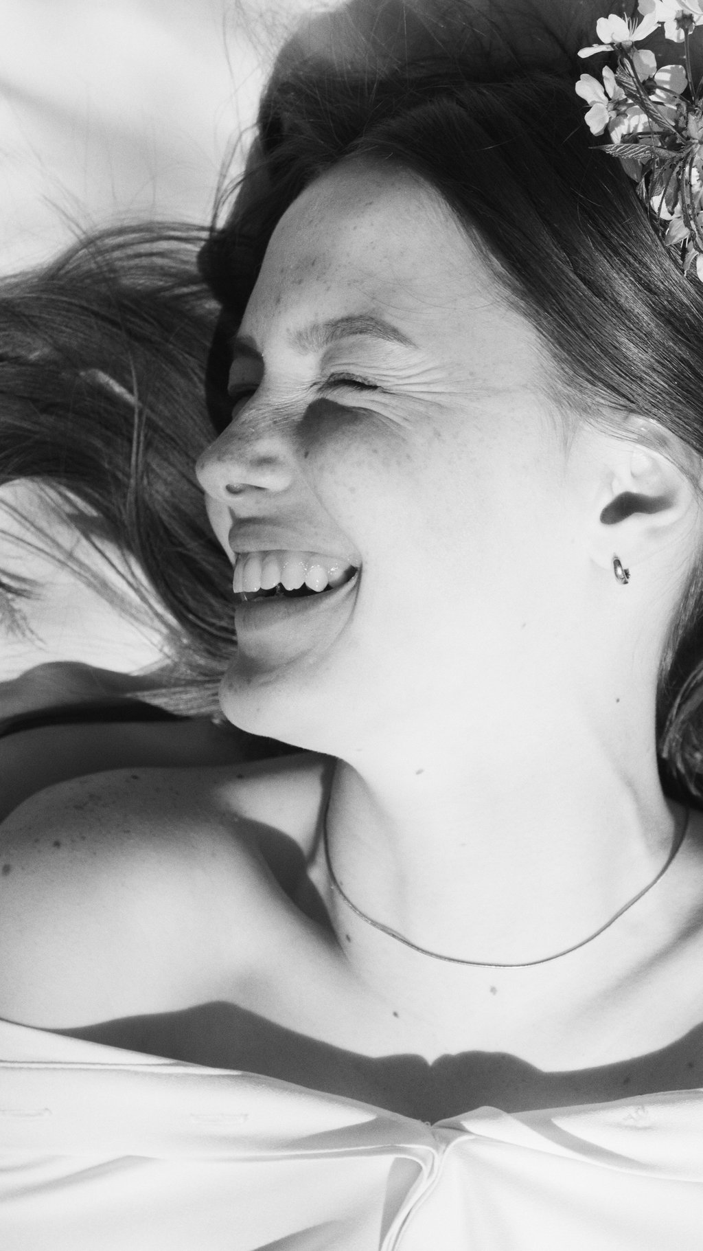 tratamiento murcia arrugas ojos patas de gallo lineas botox estética facial médico iMujer clinica