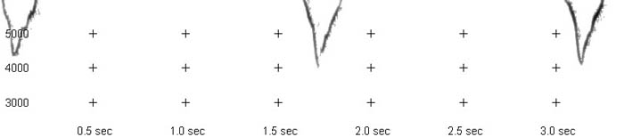 A random Yellow-browed Warbler
