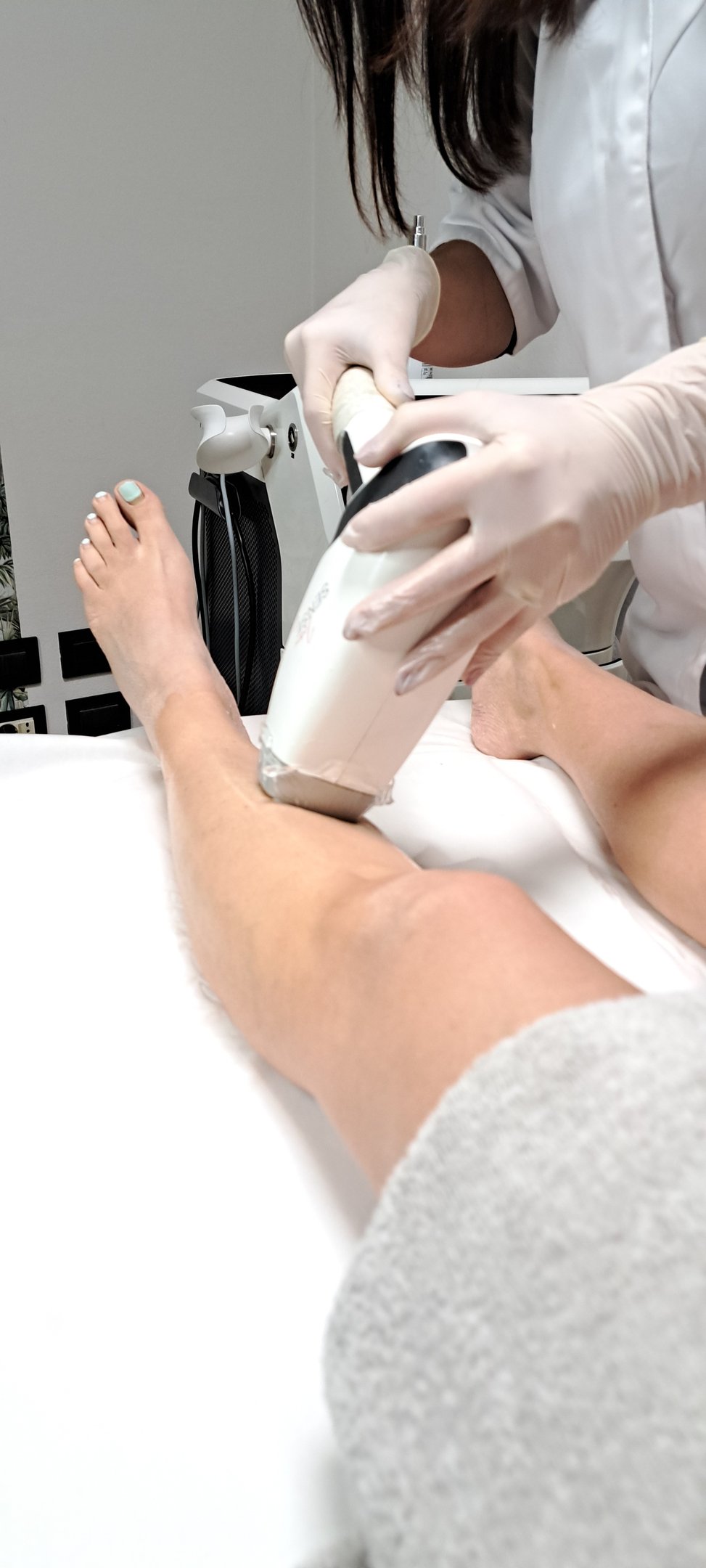 Epilazione laser al diodo cosce con tecnologia professionale per risultati duraturi