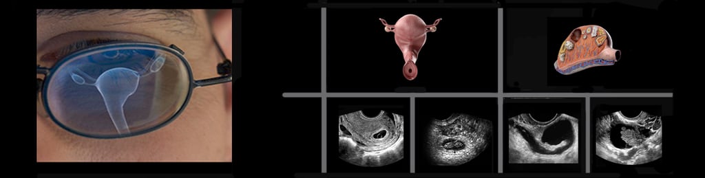 Panel of images showing transvaginal ultrasound findings.