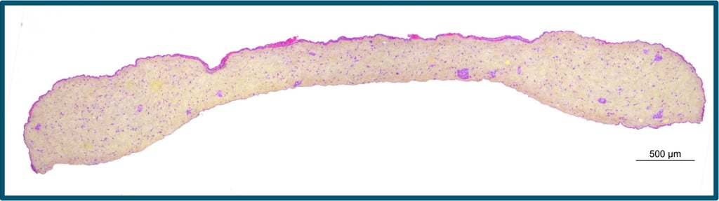 Histology cross-section of skin tissue biopsy with purple and yellow stain for cellular analysis.