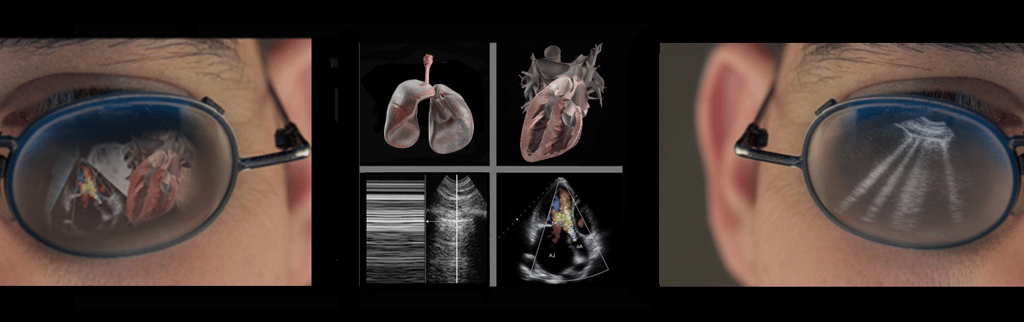 Ultrasound images of the lungs and heart with reflections of same in eyeglasses.