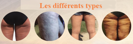 differents types