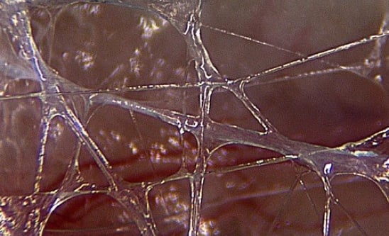 a Jean-Claude Guimberteau image about the interior of human body, biotensegrity