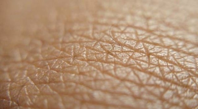 a close up of a skin - fractal skin