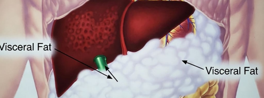 ❤️ The Fat You Can’t See: How Visceral Fat Damages the Heart & Metabolism every thing