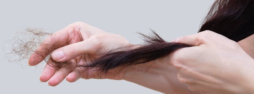 hair loss