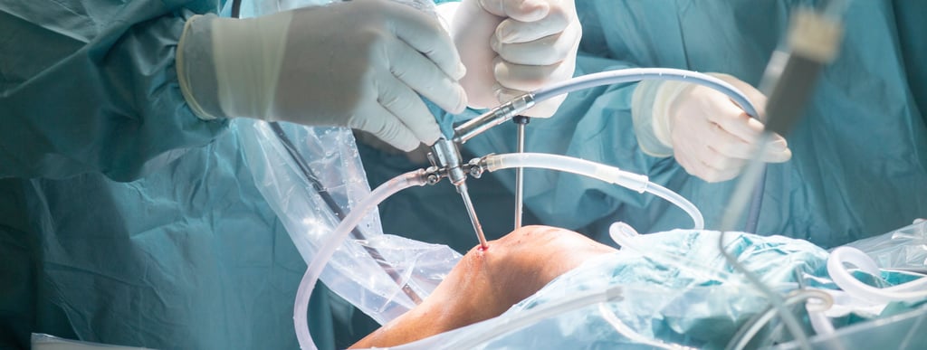 Artroscopia de rodilla