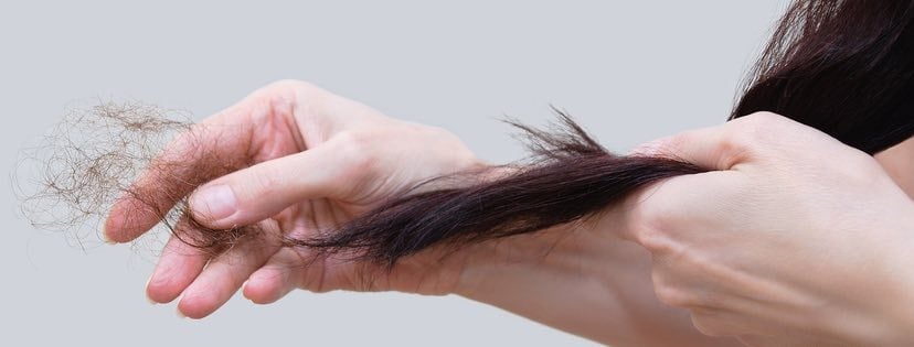 hair loss