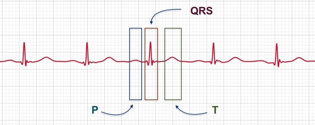 Apple Watch ECG wave diagram showing P, QRS, and T segments labeled on a cardiac rhythm strip.