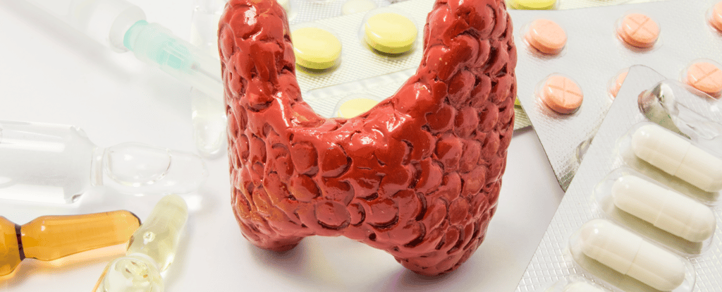 A thyroid gland