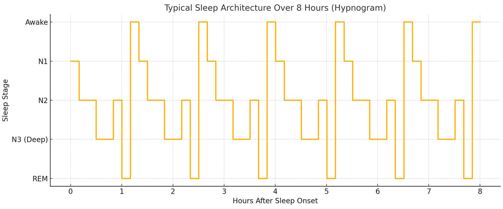 A graph of a Typical Sleep Architecture over 8 Hours (Hypnogram)