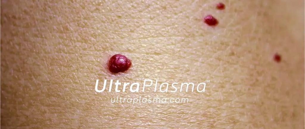 _ultra_plasma_ultra_plazma_ultra-plasma_ultra-plazma