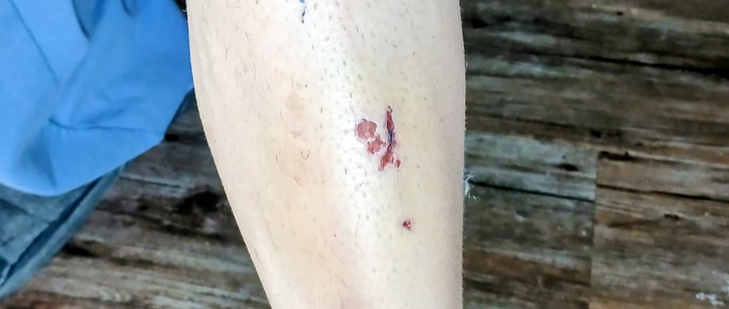 cut on shin fro pedal slip