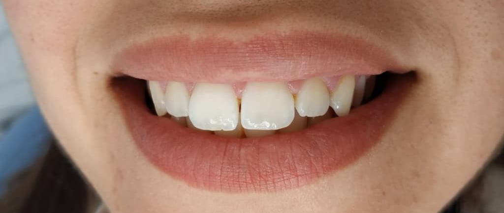 Ortodoncia infantil clinica dental ades