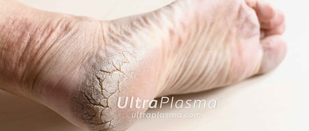 ultra_plasma_ultra_plazma_ultra-plasma_ultra-plazma