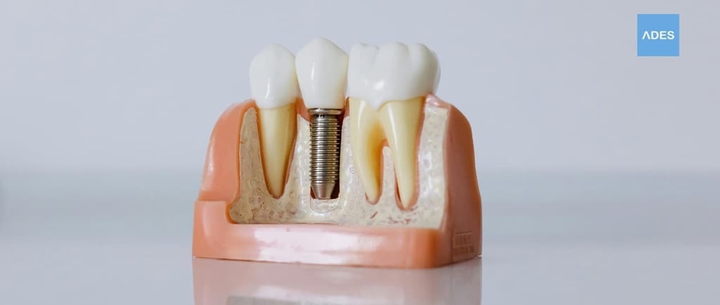 implante dental badajoz