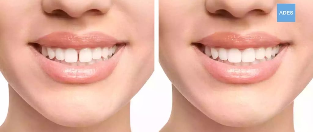 diastema badajoz