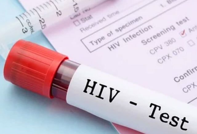 Pakistan Sees Record Surge in HIV Cases — Health Experts Warn of Looming Crisis