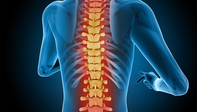 dorsalgie etiopathie