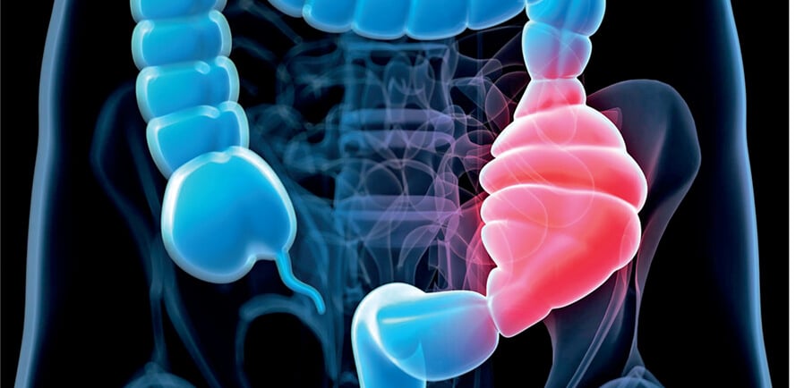 constipation etiopathie