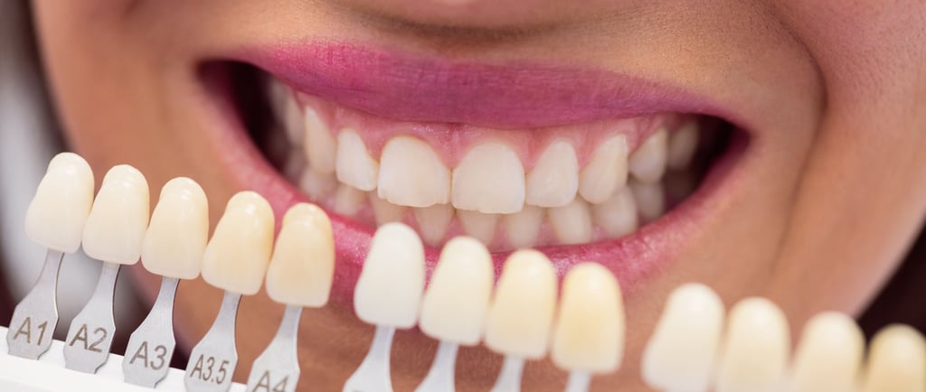 Teeth Whitening by Ekdantam Dental Clinic Navi Mumbai