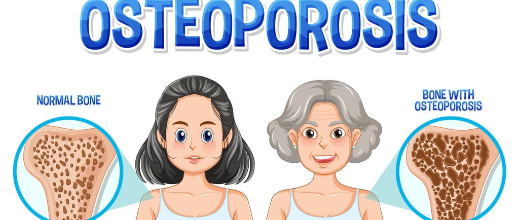 Osteoporosis