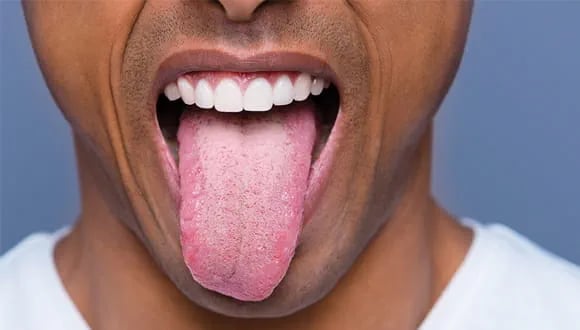 a image showing tongue