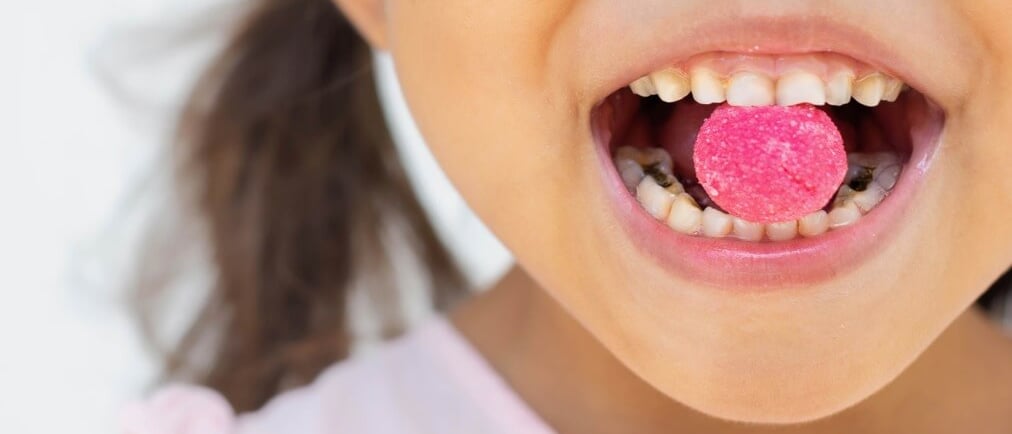 a child  with dental caries having candy in mouth
