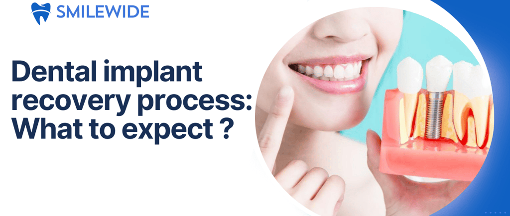A person holding dental implant model explaining dental implant recovery process