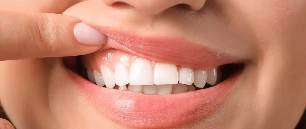 How to keep your gums healthy