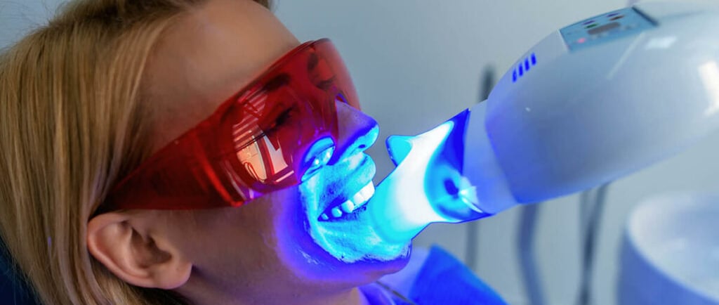 a woman undergoing teeth whitening