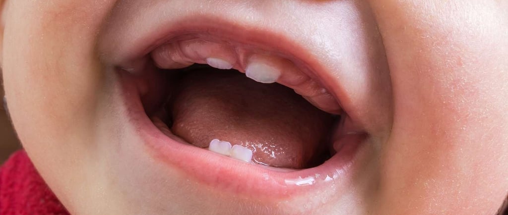 a baby mouth with four teeth in teething phase