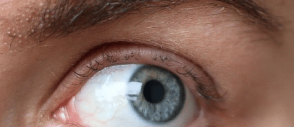 lashes damaged by lashlift