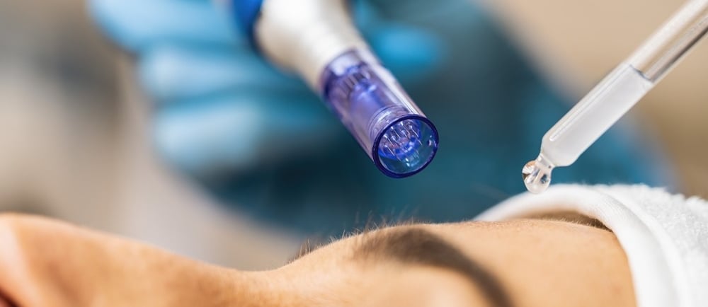 Microneedling