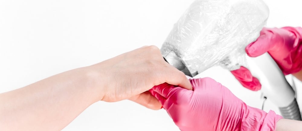 How Many Laser Sessions Do You Need for Permanent Results?