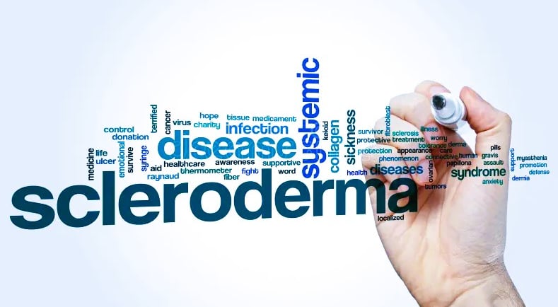 Understanding Scleroderma