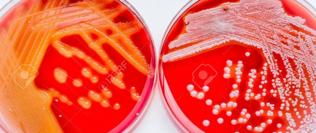 meio de cultura ágar MacConkey identificando streptococcus e staphylococcus