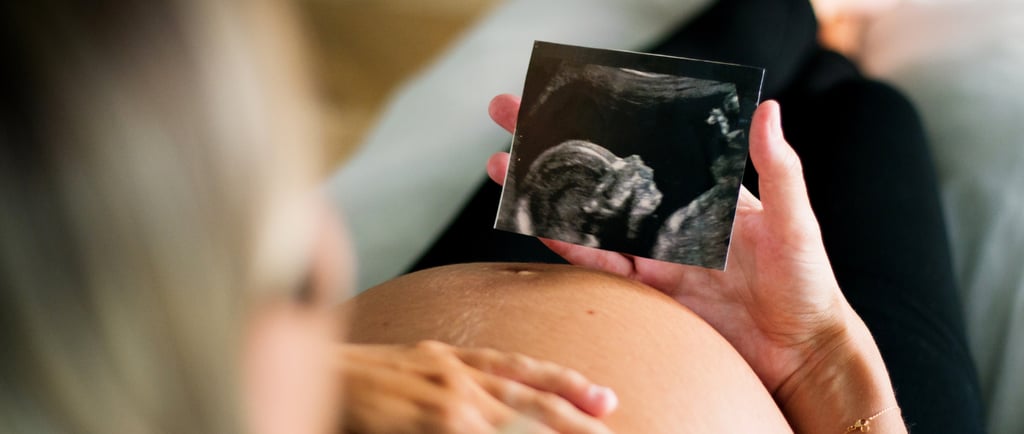 negligencia médica en el parto sufrimiento fetal