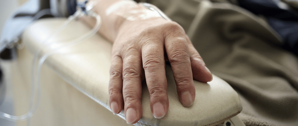 quemaduras provocadas por la quimioterapia