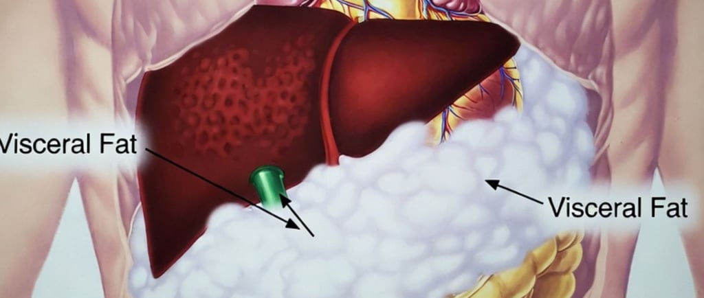 ❤️ The Fat You Can’t See: How Visceral Fat Damages the Heart & Metabolism every thing