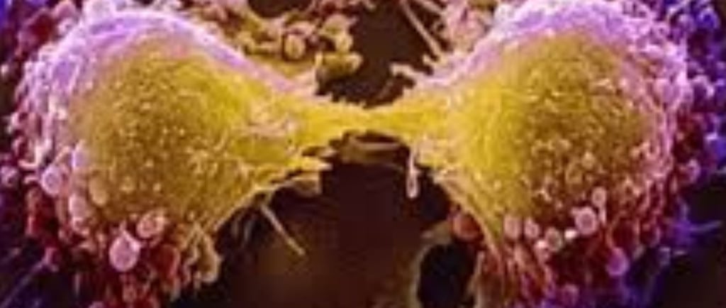 Fasting in Tumor Lysis Syndrome