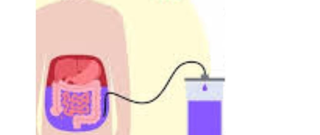 Abdominal Paracentesis Diagnostic and Therapeutic complementary issues