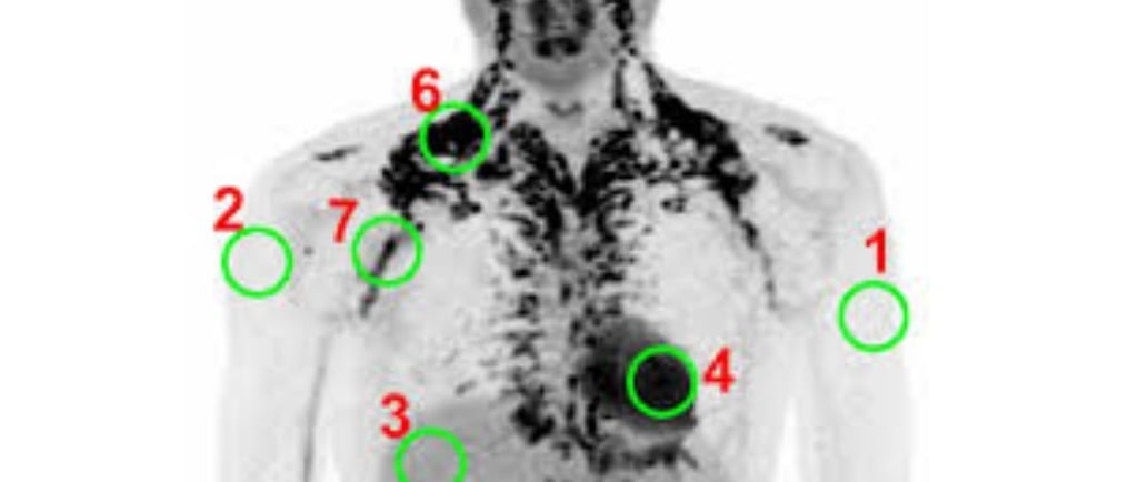 ❄️Accurate Evaluating Brown Adipose Tissue