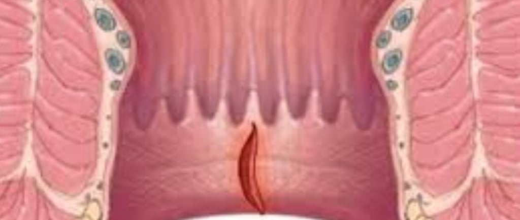 Bleeding Per Anus And Only Free Treatment