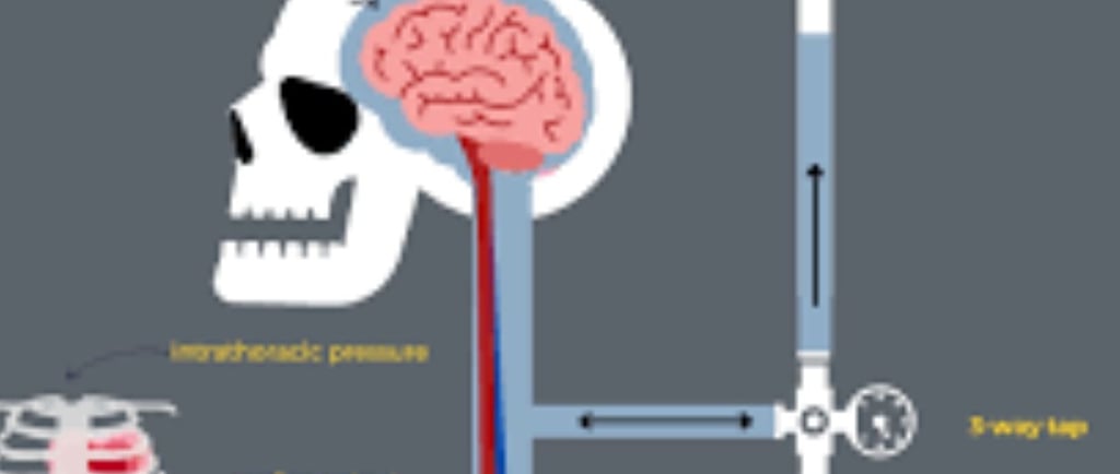 ๐ง ๐ Idiopathic Intracranial Hypertension (IIH) and Voluntary Fasting ๐