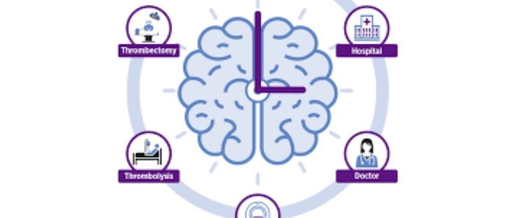 السكتة الدماغية : الأعراض والأسباب والعلاجات والإرشادات ووجهة نظر🧠 ما هي السكتة الدماغية؟ تعرف علىي