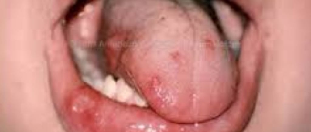 🧠⚡ السكتة الدماغية: كل ما تحتاج معرفته + وجهة نظري الشخصية 🩺💬