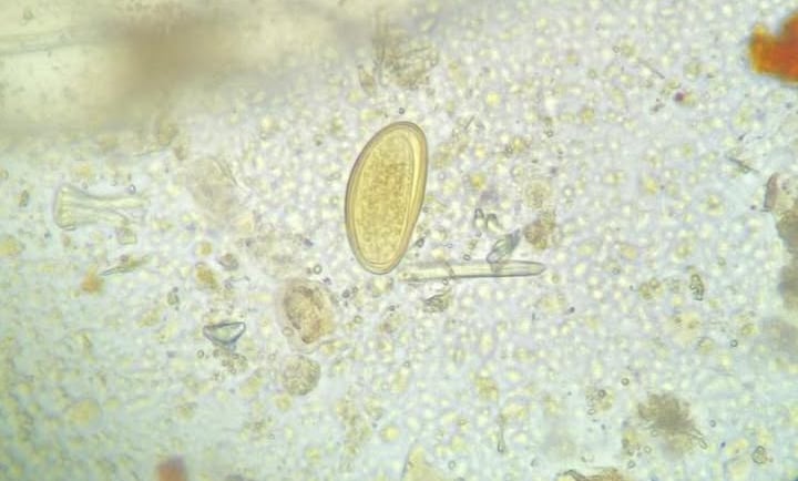 Ovo de Enterobius vermicularis