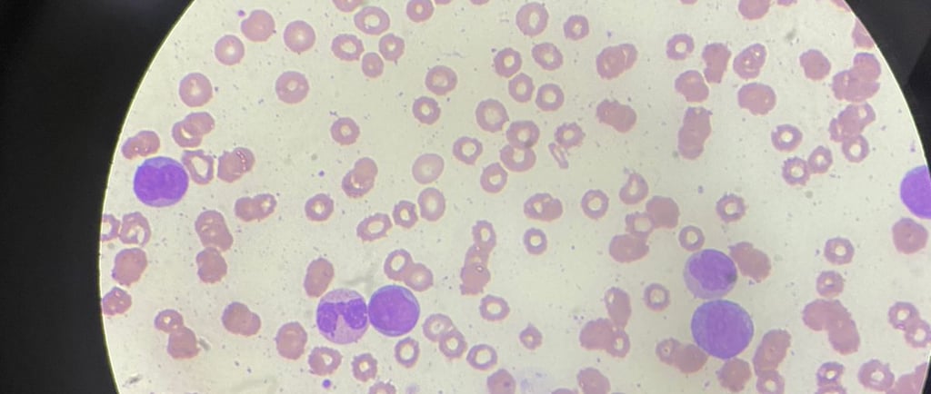 Hemograma visto do microscópio